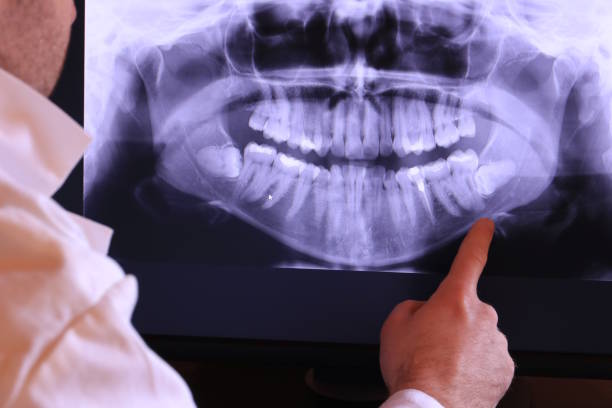 Best Cosmetic Emergency Dentistry in South Oroville, CA